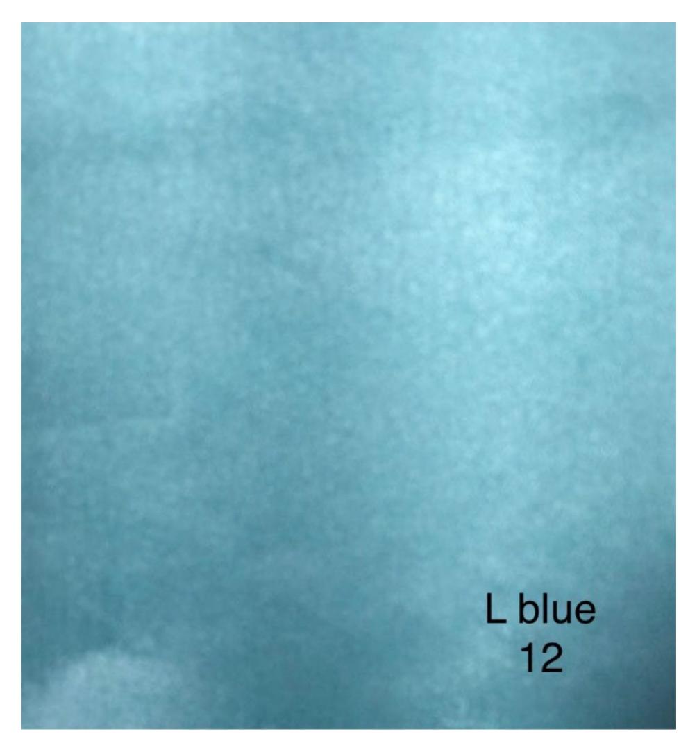L Blue